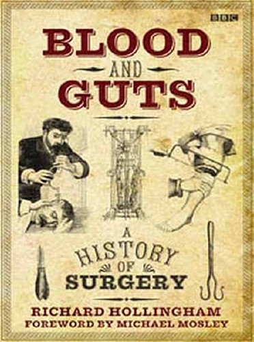 BBC:  .   / Blood and Guts. A History of Surgery. Bleeding Hearts (2009) SATRip 