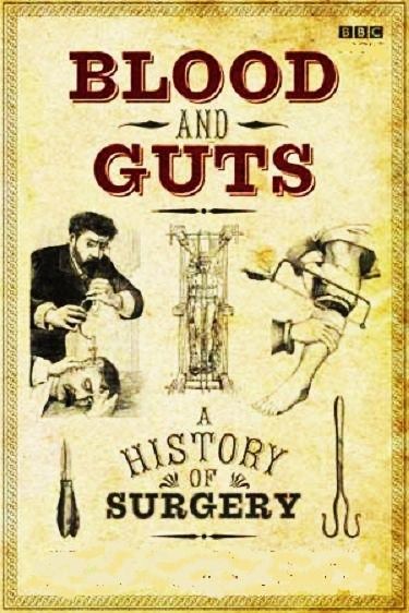 BBC - Blood and Guts: A History of Surgery 1of5 Into The Brain (2009) PDTV XviD AC3-MVGroup